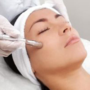 The Benefits of Microdermabrasion