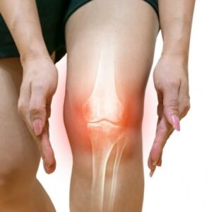 ACL Injuries: Symptoms, Treatment & Physiotherapy in Newcastle